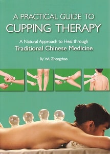 Practical Guide to Cupping Therapy